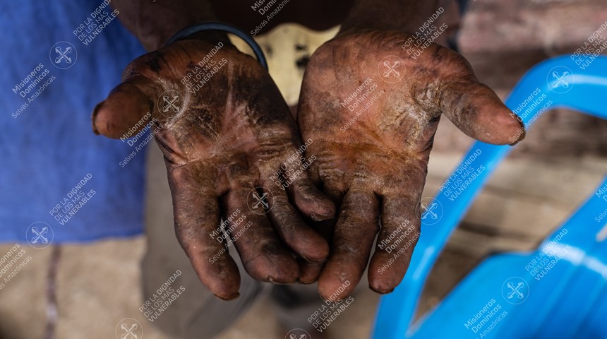 Manos trabajo duro del campo